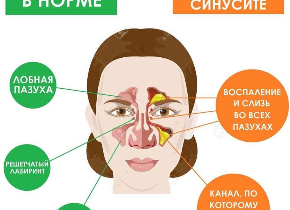 Что показывает узи пазух носа