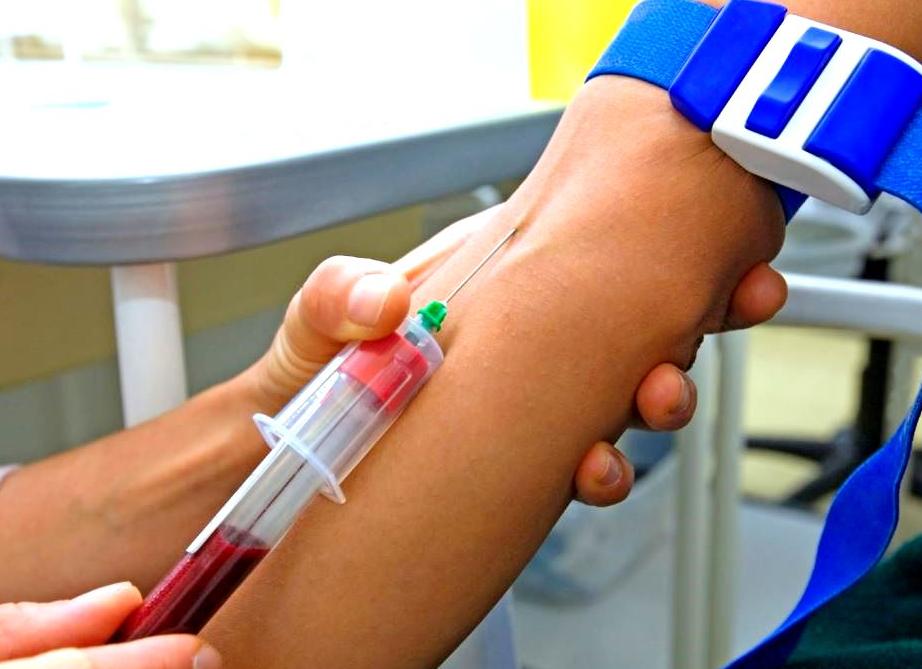 Биохимический анализ крови можно ли есть