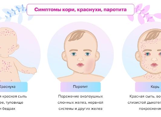Анализы перед прививкой корь краснуха паротит