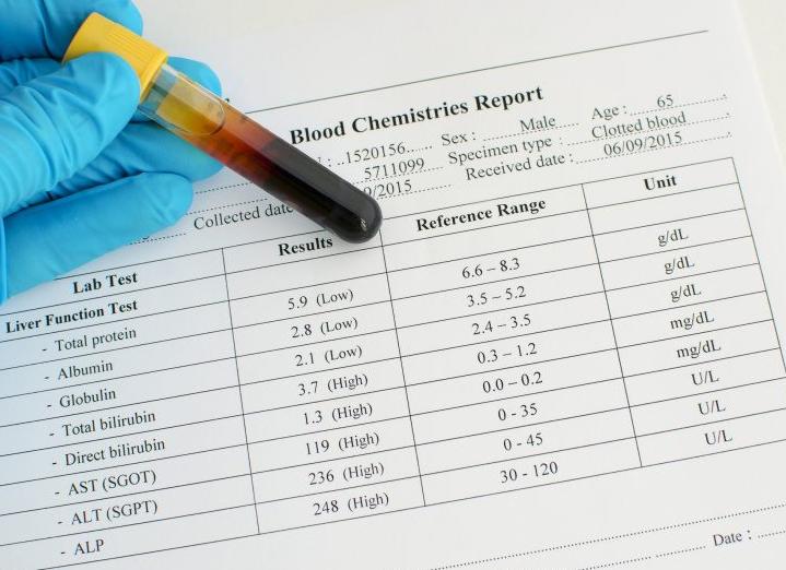 Анализ крови креатинин повышен что это значит