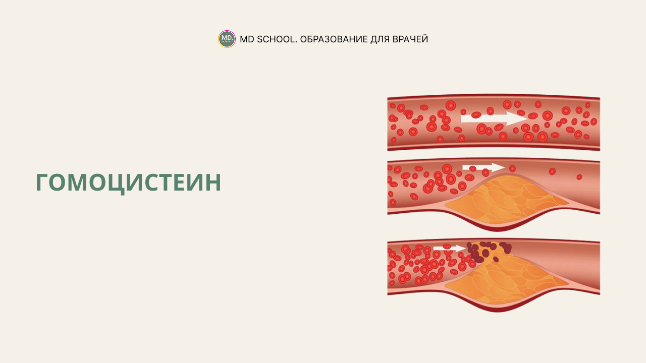 Анализ крови на гомоцистеин что это