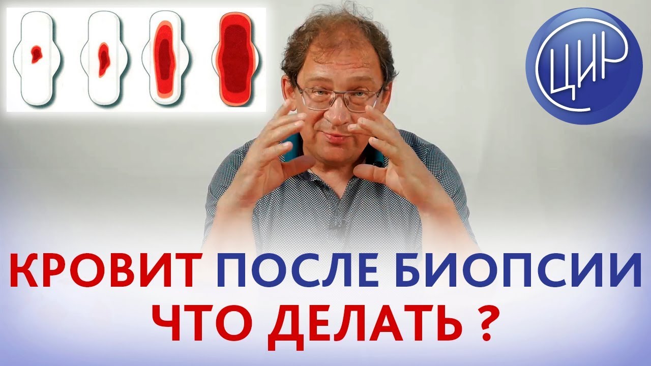 Кровь после биопсии шейки матки