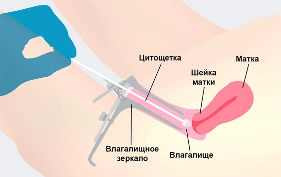 Мазок на флору у женщин из уретры