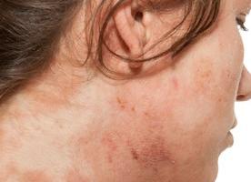 Лямблии у детей откуда берутся