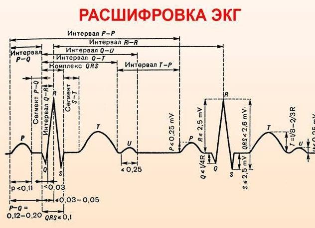 Кардиограмма сердца расшифровка норма