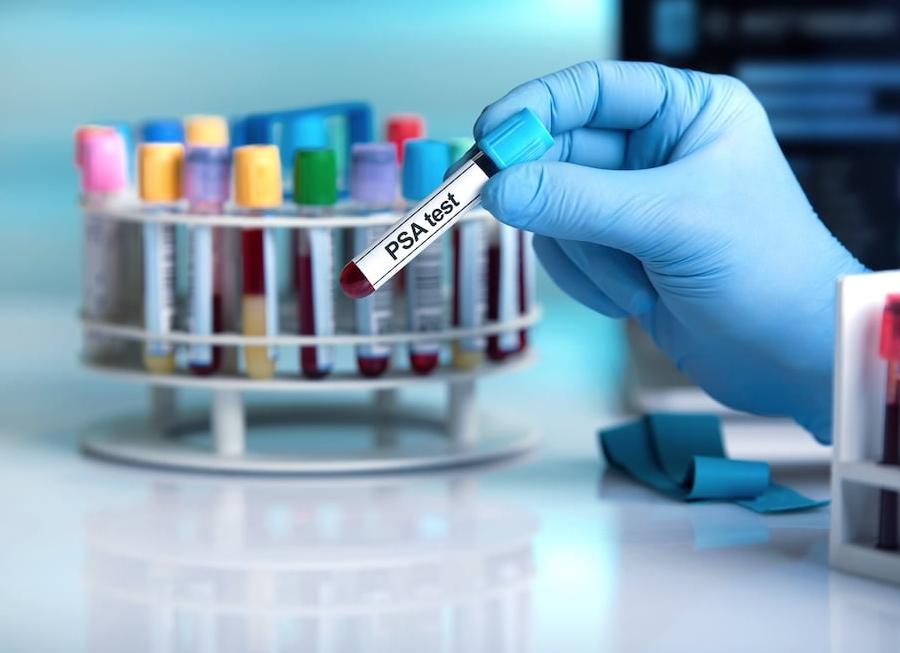 Индекс пса норма в процентах