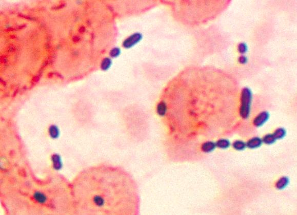 Энтерококк что такое