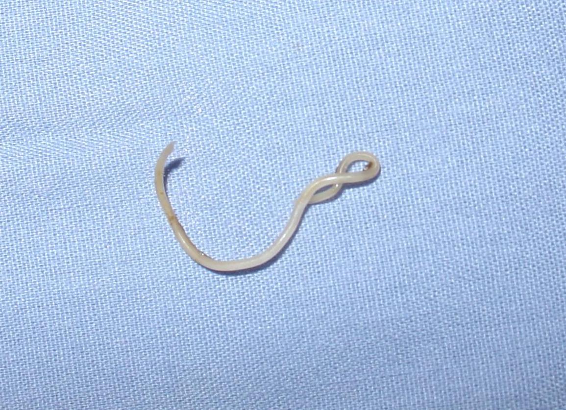 Что такое токсокароз