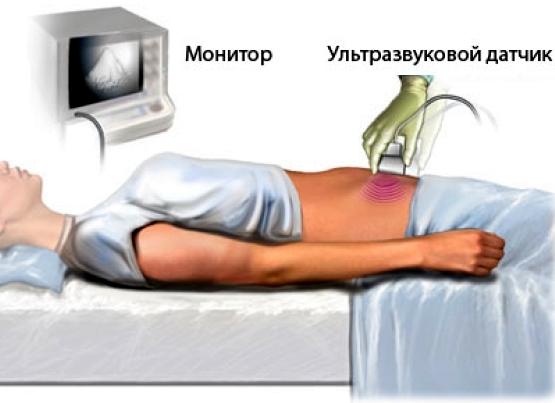 Абдоминальное узи что показывает