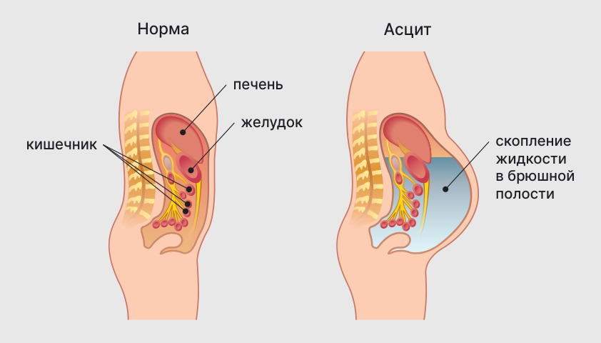 Как проверяют печень у человека