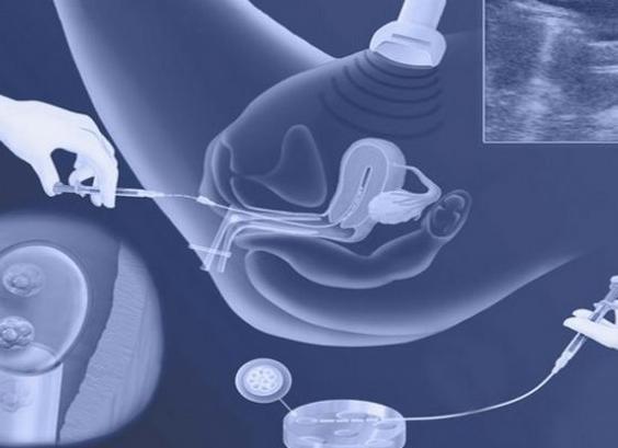 На какой день делают перенос эмбрионов