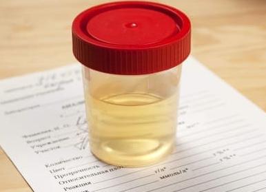 Мутная моча у ребенка что это может быть