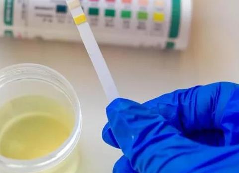 Кетоны в моче у ребенка