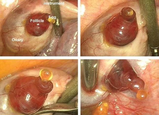 Как выглядит яйцеклетка