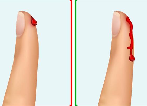 Как понять что густая кровь