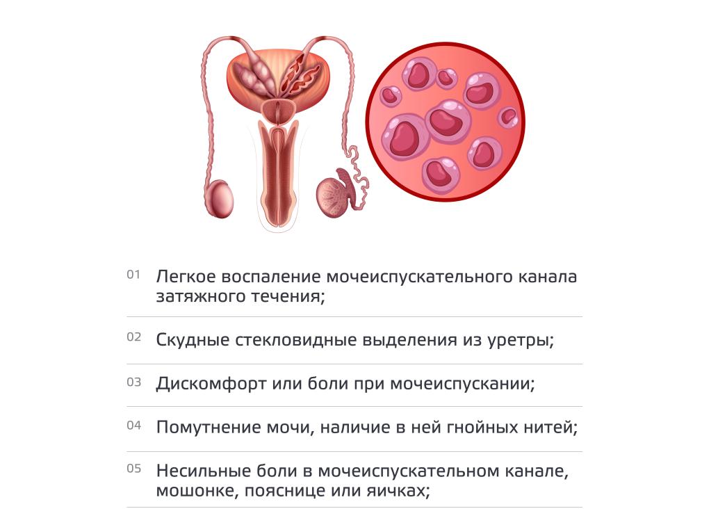Как лечится хламидиоз у мужчин Как лечится хламидиоз у мужчин