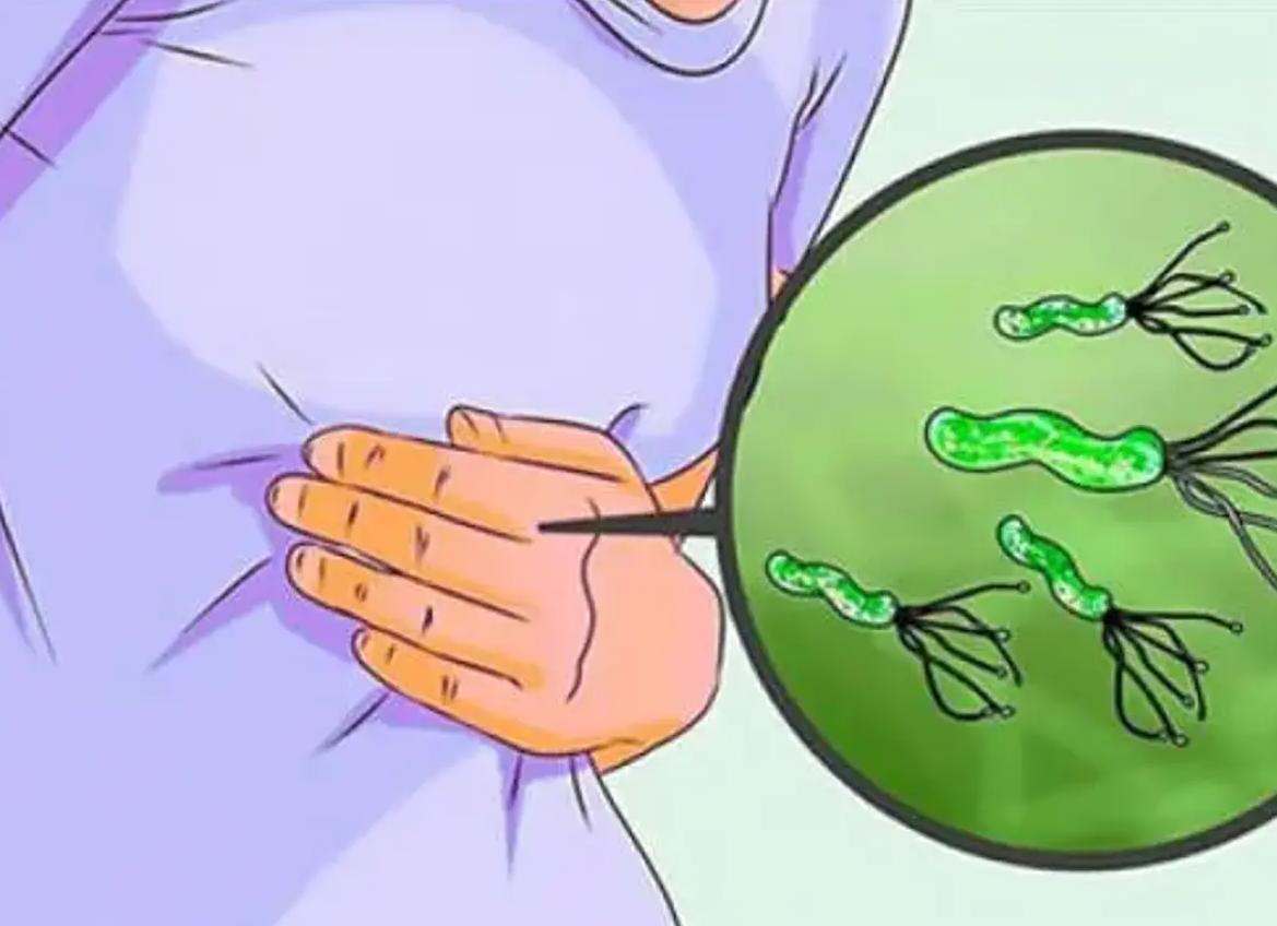 Хеликобактер пилори 1 20 что это значит