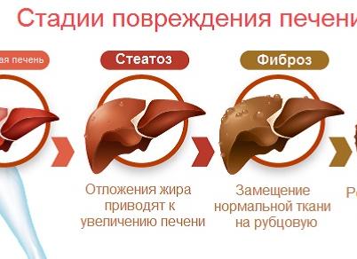 Диффузное поражение печени