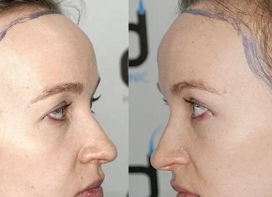 Что такое у женщин гв