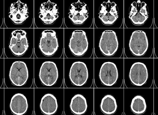 Что проверяет мрт