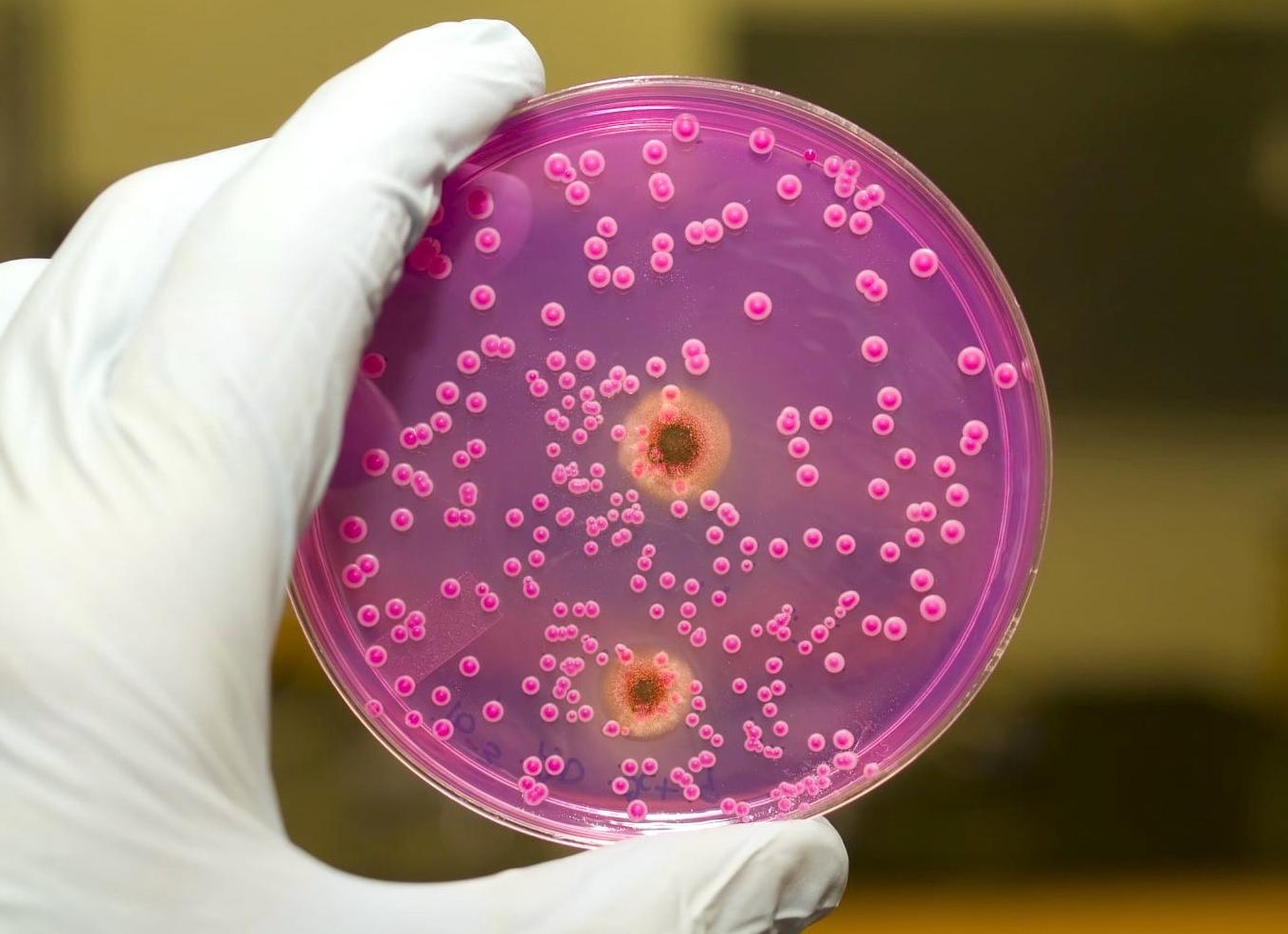 Чем опасен трихомониаз Чем опасен трихомониаз