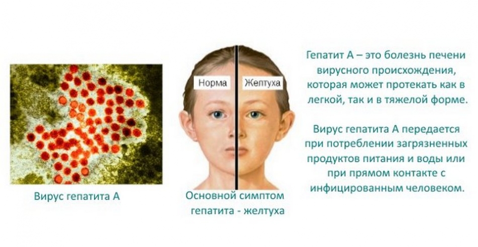 Гепатит с что это за болезнь