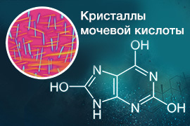 Мочевая кислота выше нормы что это значит