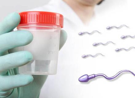 Как сдают сперму Как сдают сперму