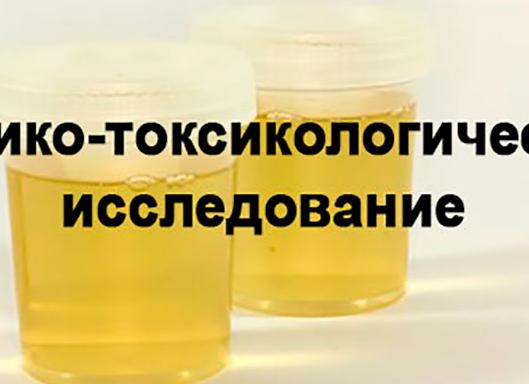 Химико токсикологический анализ мочи