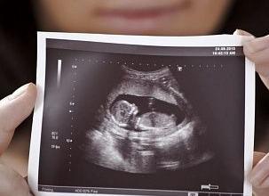 Эмбрион не визуализируется что это значит