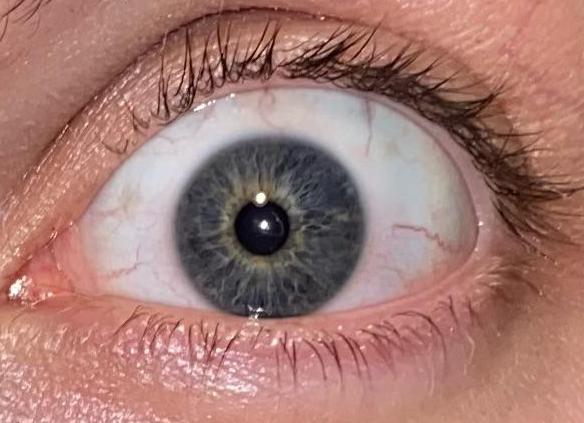 Эдс отрицательный что это