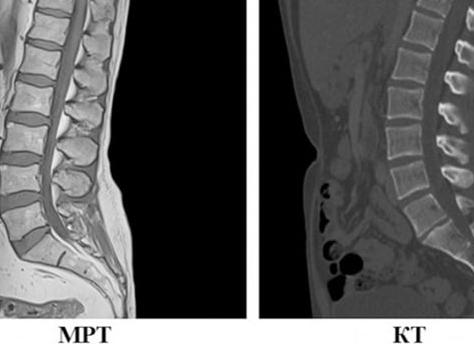Что точнее мрт или кт