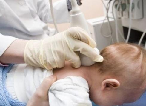 Что показывает узи шейного отдела позвоночника