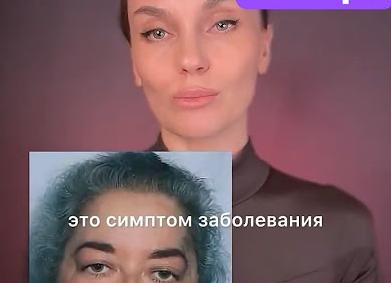 Андрогенизации у женщин это