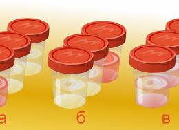 Анализ мочи три стакана