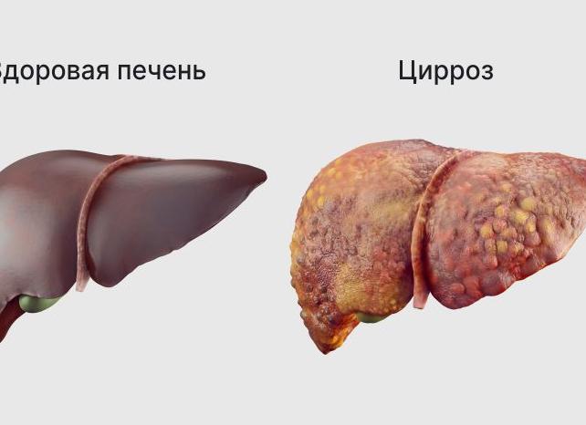 Алт понижен что это значит