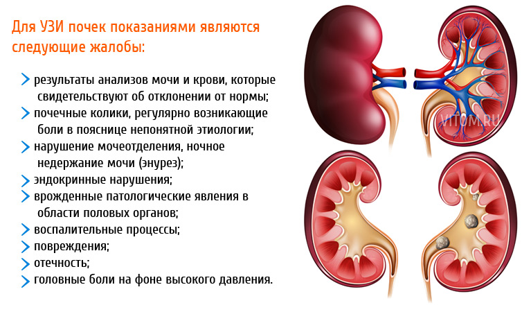 Как делать узи почек натощак или нет