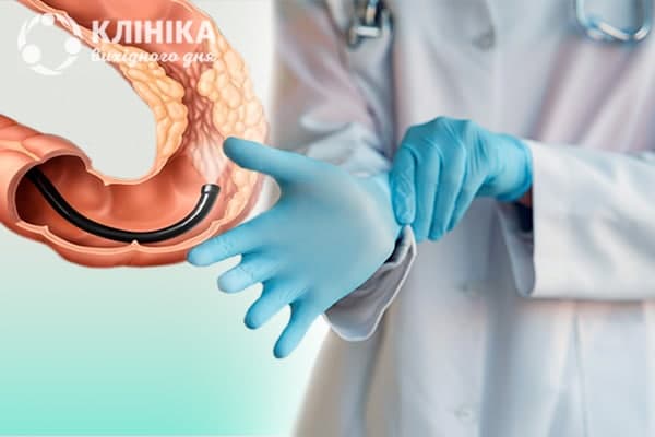 Как осматривает женщин проктолог