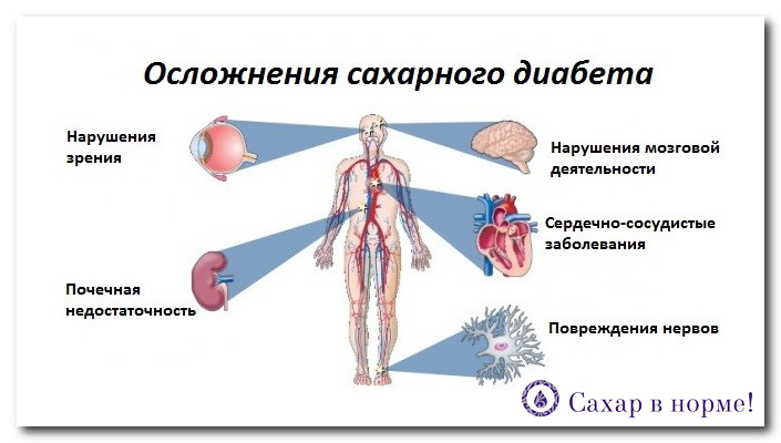 Какие анализы нужно сдать при сахарном диабете