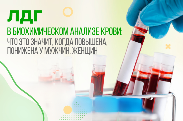 Лдг в крови понижен