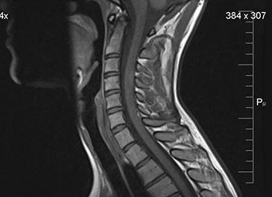 Мрт шоп что это