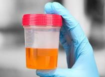 Моча при пиелонефрите