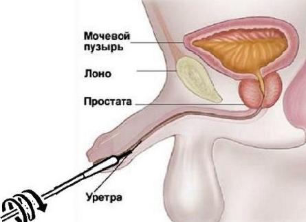 Мазок у парней как берут Мазок у парней как берут