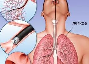 Как делают бронхоскопию
