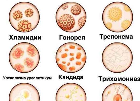 Инфекционные заболевания передаются половым путем