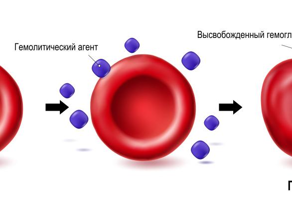 Гемоглобин в моче причины