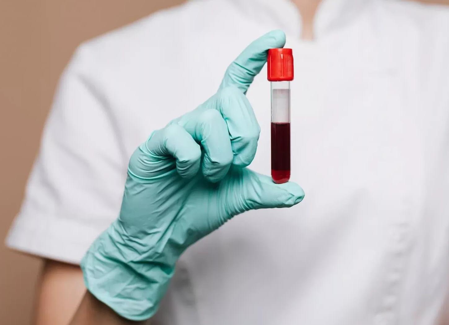 Биохимия крови можно ли кушать