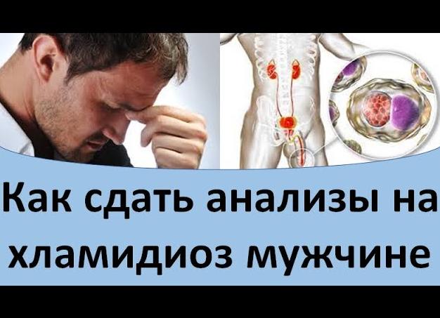 Анализы на хламидиоз у мужчин