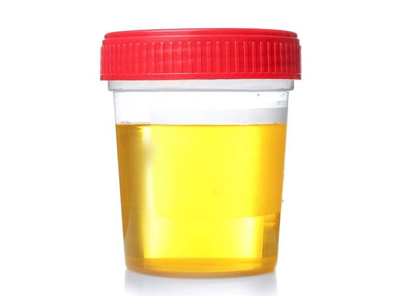 3 х стаканная проба мочи