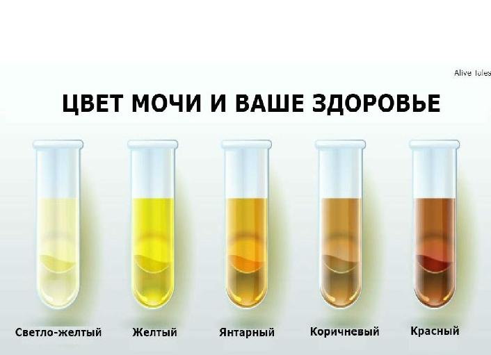 Моча цвета пива отмечается при Моча цвета пива отмечается при